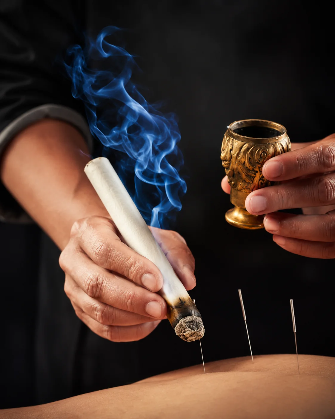 Aplicación de moxibustión como complemento de la acupuntura